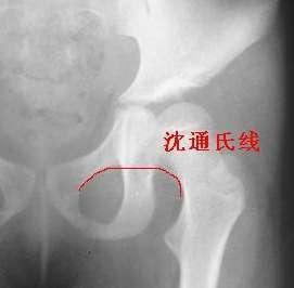 5243fbf2b2119313204b1ff465380cd791238d6e