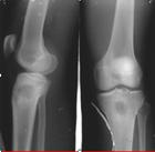 u=3370559321,1611106235&fm=15&gp=0